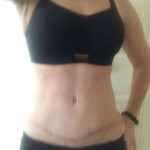 6 months 2 weeks and 2 days after tummy tuck
