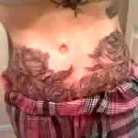 Tummy tuck picture of tattoo