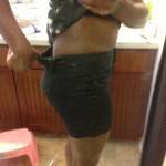 Full tummy tuck before and after photos (4)