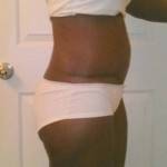 Pictures of full tummy tuck
