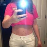 Pictures of tummy tuck (12)
