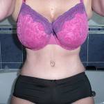 Pictures of tummy tuck (2)