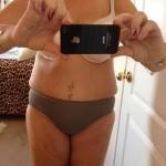 Pictures of tummy tuck images