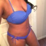 Tummy tuck abdominoplasty results pictures