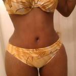 Mini tummy tuck pictures before and after Atlanta best cosmetic surgeons