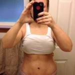 Mini tummy tuck pictures before and after of belly button scar snapshots