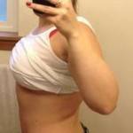 Mini tummy tuck pictures before and after procedure pics