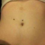 belly piercing after tummy tuck surgery