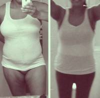 Tummy tuck photos before and after blogs image