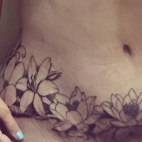 Tummy tuck and tattoo cover ups