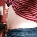 13 weeks after tummy tuck op