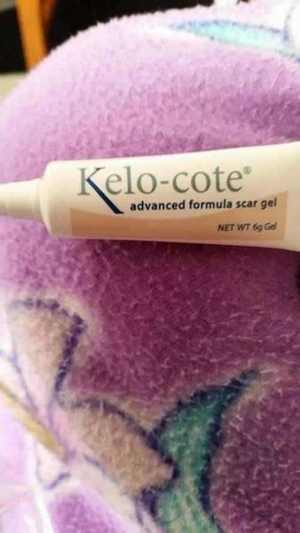 Kelo-cote to tummy tuck scar