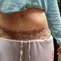 Scar becomes unnoticed thanks to tummy tuck tattoo