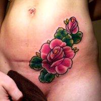Tummy Tuck Tattoo Cover Ups Pictures (13)