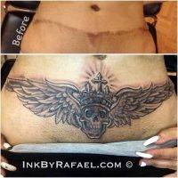 Tummy Tuck Tattoo Cover Ups Pictures (18)