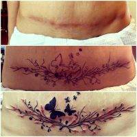 Tummy Tuck Tattoo Cover Ups Pictures (19)