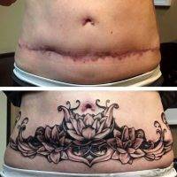 Tummy Tuck Tattoo Cover Ups Pictures (33)