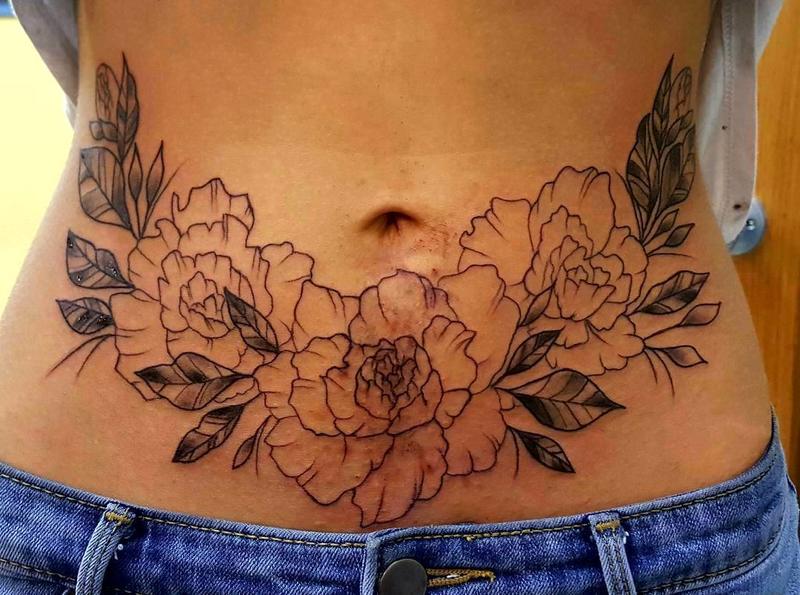 Tummy Tuck Tattoo Cover Ups Pictures (41) .