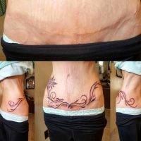 Tummy Tuck Tattoo Pics (10)