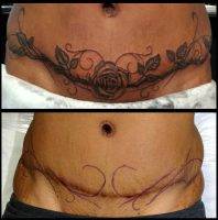 Tummy Tuck Tattoo Pics (5)