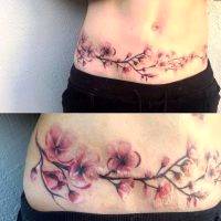 Tummy Tuck Tattoo To Cover Scar Pictures (3)