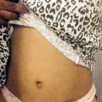 Tummy tuck before and after pictures online