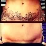 Tummy tuck tattoo before and after