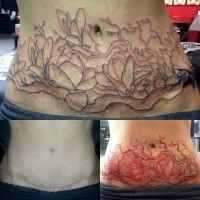 Tummy tuck tattoo before and after 2