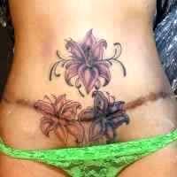 tattoos for tummy tuck scars