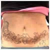 tattoos for tummy tuck scars 5