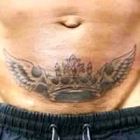 tattoos over tummy tuck scars pictures