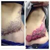 tummy tuck cover up tattoos 7