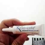 Kelo-cote scar gel after tummy tuck