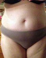 Gaining weight after tummy tuck