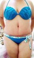 How much for a abdominoplasty surgery
