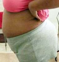 A tummy tuck then pregnancy
