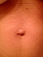 Mini tummy tuck versus full belly button