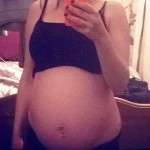Pregnancy after abdomiplasty pictures (3)