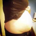 Pregnancy after tummy tuck photo (1)