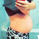 Pregnancy after tummy tuck photo (3)