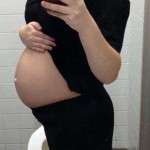 Pregnancy after tummy tuck picture (5)