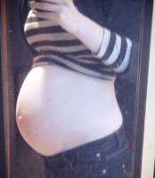 Pregnancy after tummy tuck surgery image