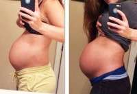 Pregnancy after tummy tuck surgery images