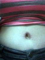 Recovery tummy tuck 4 weeks