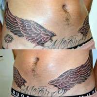 Tattoos to cover tummy tuck operation