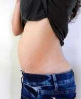 Tummy tuck with c section picture