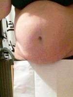 Weight loss with tummy tuck picture