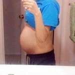 pregnancy after abdominoplasty photos (5)