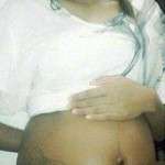 pregnancy after tummy tuck surgery photos (2)