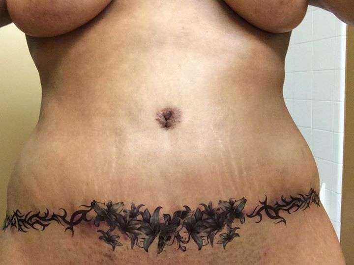 ←. Tummy tuck cover up tattoos. 